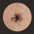 Ticks